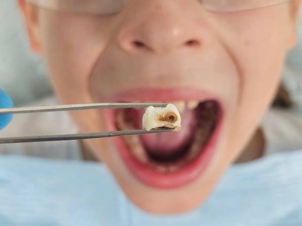 Best Pediatric Emergency Dentist in Stratmoor, CO